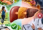 Hígado graso: cómo prevenirlo, cuidar tu hígado y evitar que avance